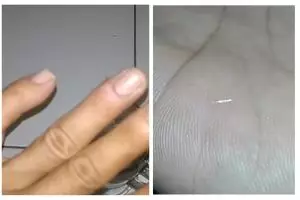 Trik mengeluarkan duri ikan di tangan tanpa jarum atau air hangat, aman tak sakit pakai 1 bahan dapur