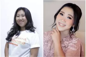 Potret wajah 15 seleb sebelum dan sesudah permak dagu, perubahannya drastis jadi tampak tirus