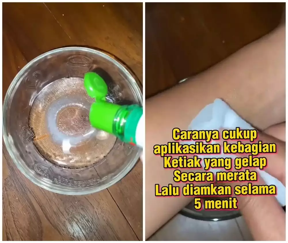 cara atasi ketiak gelap pakai garam © YouTube
