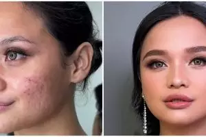 Bukan langsung diset foundation, ini trik menutup bekas jerawat dan bopeng agar makeup lebih smooth