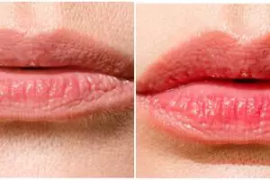 Cara membuat bibir merah merona alami cuma dengan lip scrub dari 2 bahan pemanis