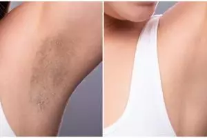 Tanpa lotion pemutih, ini cara atasi ketiak gelap agar lebih cerah cuma dengan 2 bahan dapur