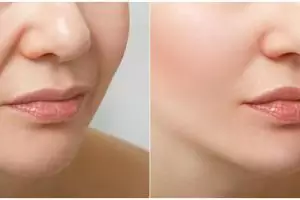 Tak perlu serum retinol, begini cara mengencangkan kulit agar bebas garis halus dengan modal Rp0