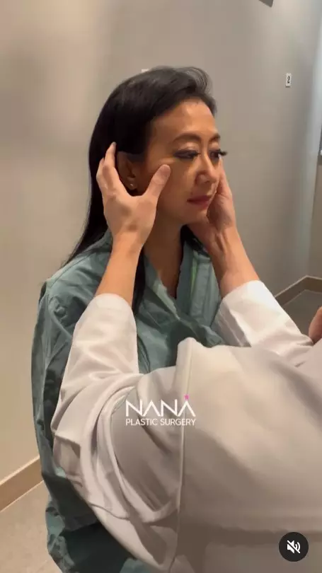 Asri Welas usai operasi anti aging © berbagai sumber Asri Welas usai operasi anti aging © berbagai sumber