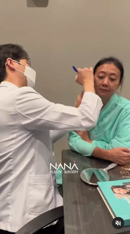 Asri Welas usai operasi anti aging © berbagai sumber Asri Welas usai operasi anti aging © berbagai sumber