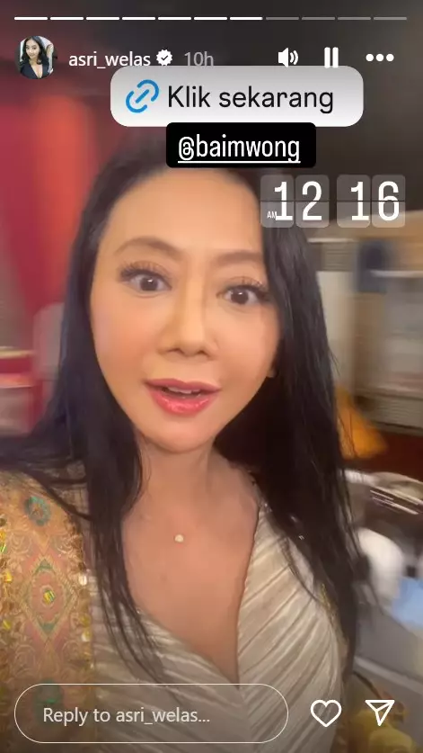 Asri Welas usai operasi anti aging © berbagai sumber Asri Welas usai operasi anti aging © berbagai sumber