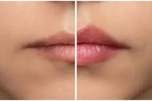 Cara bikin lip balm untuk cerahkan bibir hitam pakai 1 jenis bunga, nggak usah pakai madu dan beeswax