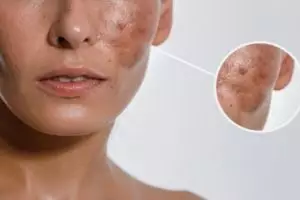 Nggak perlu facial mahal, begini cara membuat masker dari kopi dan lidah buaya yang aman