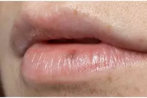 Merah alami tanpa sulam, begini cara atasi bibir menghitam cuma pakai 1 jenis umbi-umbian