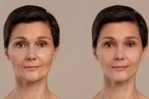 Cara hempas sebum berlebih pada kulit pakai 2 jenis buah, pori-pori auto rapat