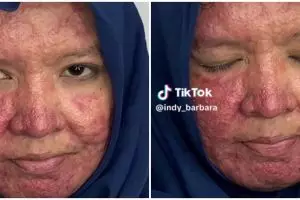  Wajah bopeng gegara gonta-ganti skincare, MUA ini ubah muka pengantin Sunda jadi manglingi