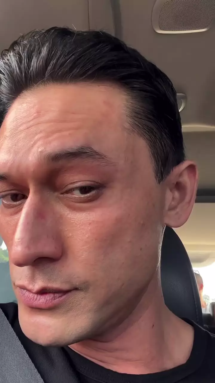 indra bruggman usai oplas mata © 2025 Instagram indra bruggman usai oplas mata © 2025 Instagram