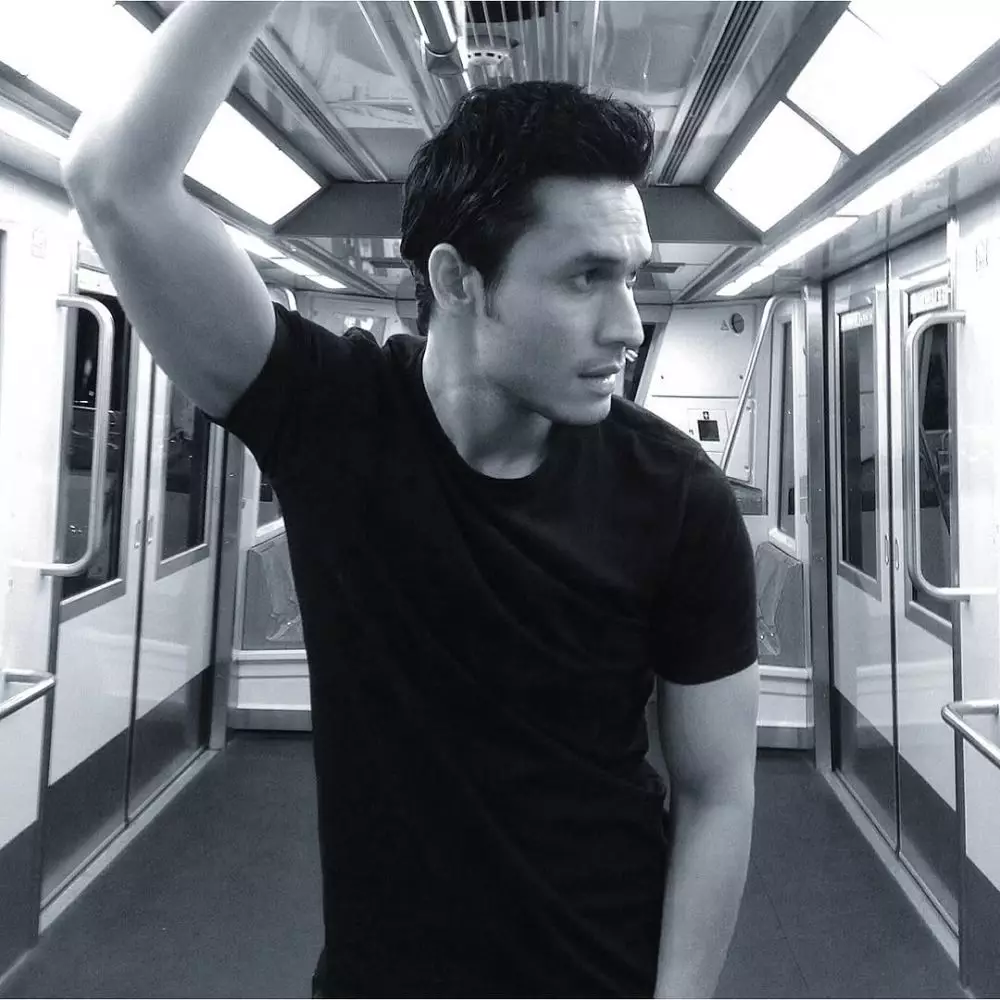 indra bruggman usai oplas mata © 2025 Instagram indra bruggman usai oplas mata © 2025 Instagram