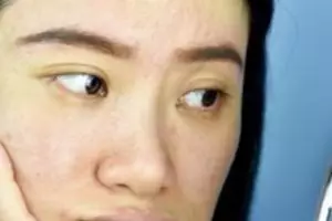 Kulit auto glowing sampai dikiran oplas, begini cara hilangkan flek hitam hanya pakai 1 jenis lalapan