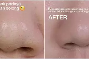 Pori-pori tampak bolong meski pakai skin prep? Ini trik mengatasinya agar complexion lebih blurring