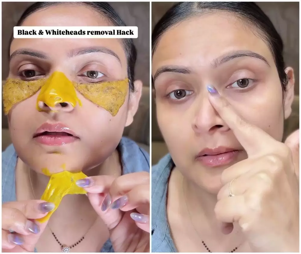 bersihkan komedo ini bikin pori-pori mengecil © Instagram