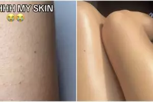 Cara menghilangkan strawberry skin pada kaki, kulit mulus dengan scrub dari 3 bahan dapur