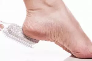 Cara mudah atasi tumit pecah-pecah pakai tambahan 1 jenis buah, jadi makin pede pakai sandal apa aja