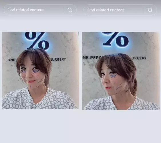 Gisella Anastasia jalani oplas ke Korea © TikTok