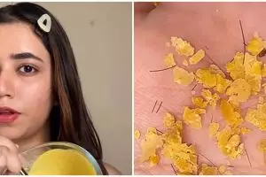 Dijamin nggak bikin sakit, ini cara aman menghilangkan bulu halus di wajah tanpa waxing lilin