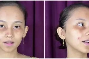 Transformasi makeup cewek berjerawat dengan satin-bold ini hasilnya bikin lupa wajah asli