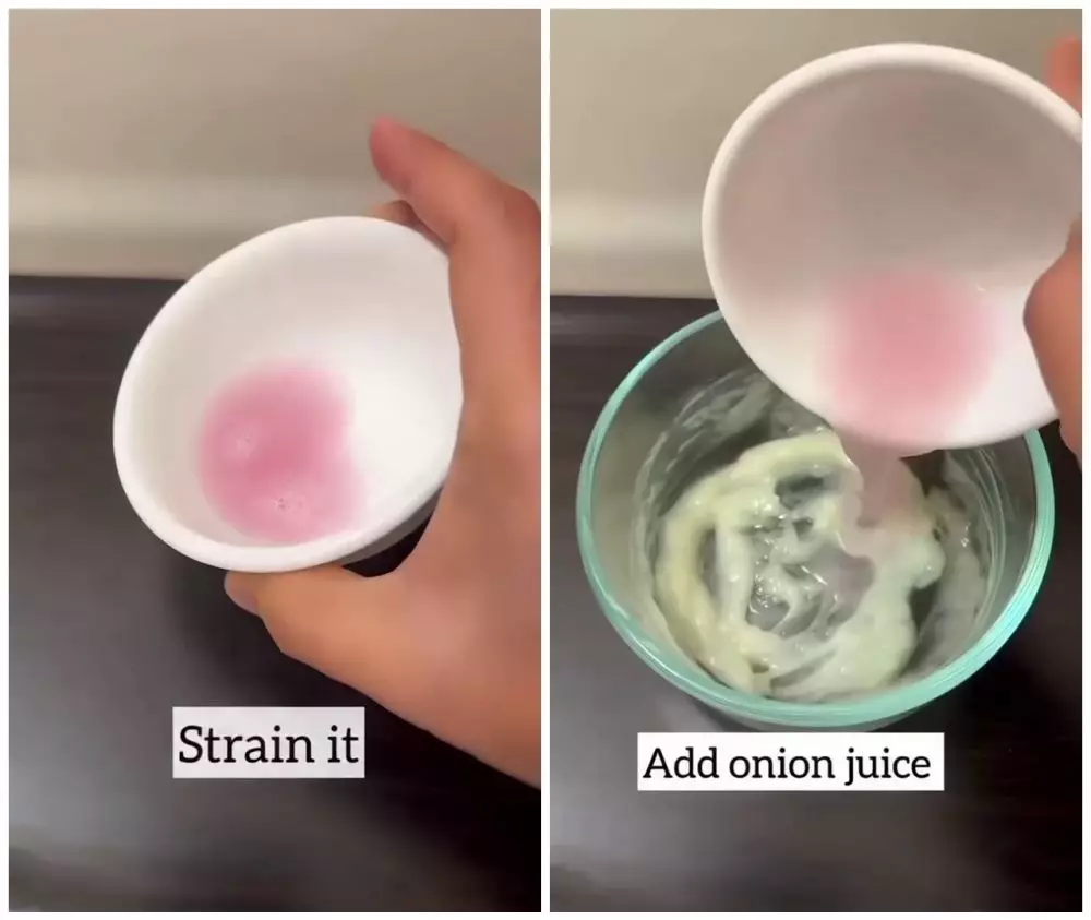 Cara alami menumbuhkan rambut tipis © Instagram