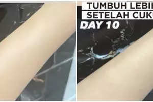 Trik agar kulit tangan selalu mulus usai waxing, bulu auto lama tumbuh dengan 2 jenis buah ini
