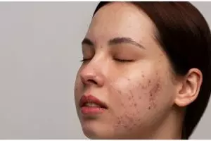 Cara samarkan pori-pori agar wajah bebas minyak cuma pakai 1 jenis minuman, nggak perlu touch-up bedak