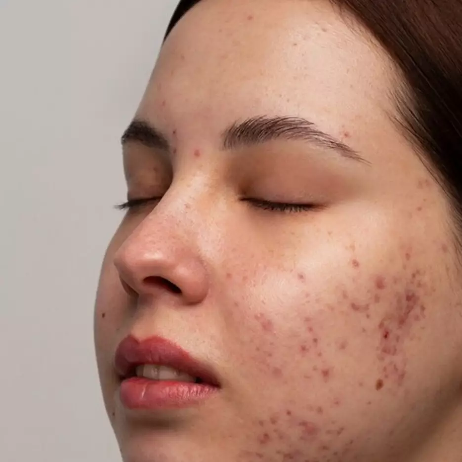 Cara samarkan pori-pori agar wajah bebas minyak cuma pakai 1 jenis minuman, nggak perlu touch-up bedak