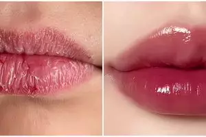 Cara cerahkan bibir hitam agar merah alami & plumpy tanpa treatment klinik, cukup pakai 3 bahan dapur