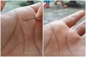 Trik keluarkan duri dari jari tangan tanpa rasa sakit ini andalkan 1 bumbu dapur, mudah dipraktikkan