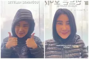 Lakukan facelift untuk hilangkan kerutan, 9 potret Uut Permatasari usai oplas bikin tampak awet muda