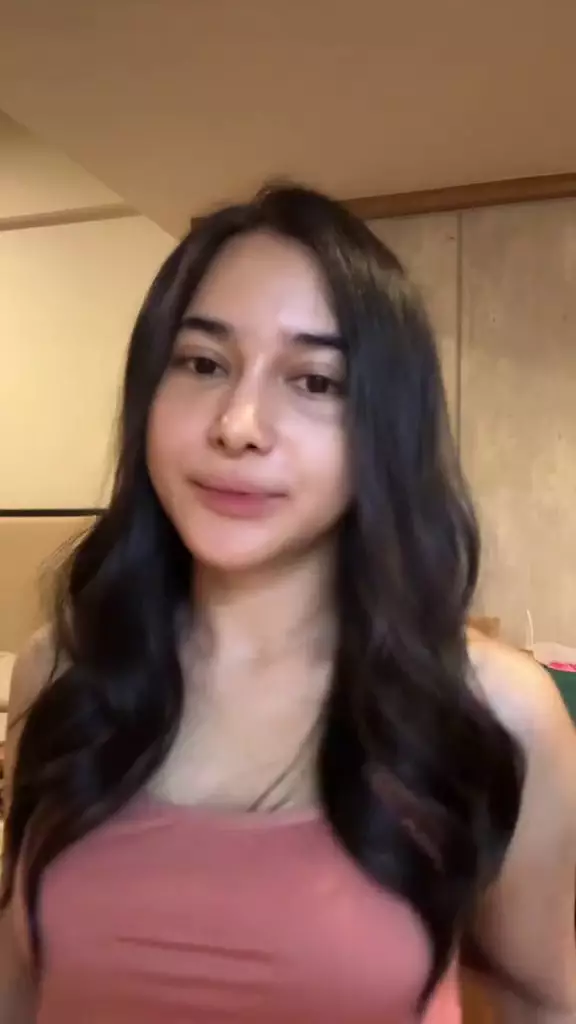 wajah dilan janiyar operasi plastik tak berubah © 2025 TikTok wajah dilan janiyar operasi plastik tak berubah © 2025 TikTok