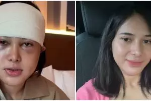 9 Potret Dilan Janiyar seleb TikTok usai oplas di Korea, tak banyak berubah tetap cantik natural