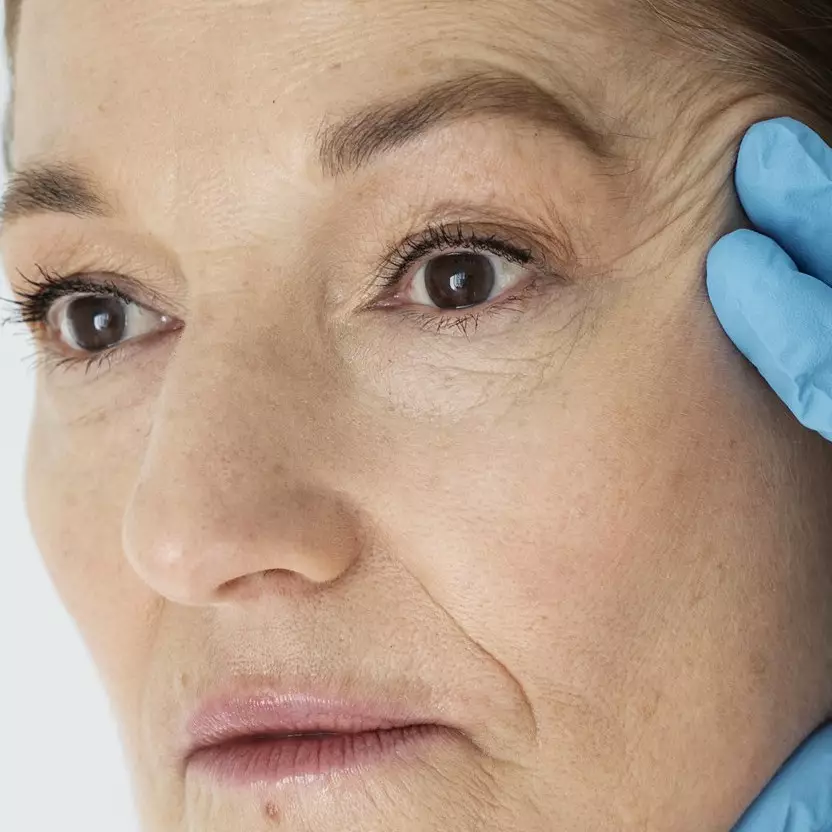 Ternyata cara menghilangkan garis halus pada wajah bisa pakai bahan rempah, hasilnya bikin takjub