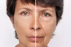 Sekarang nggak perlu khawatir, ternyata membersihkan pori-pori wajah bisa pakai ampas minuman