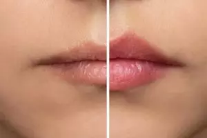 Kini jadi lebih mudah, ternyata begini cara simpel pudarkan bibir gelap pakai 1 jenis minuman