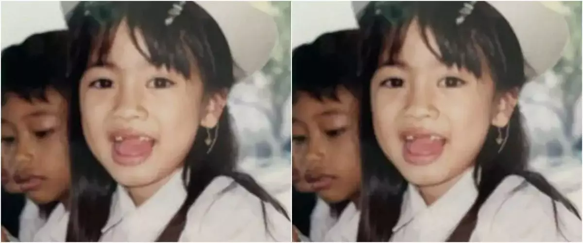 Bocah ompong ini dulunya pesinetron kondang, kini malah sukses jadi bos skincare