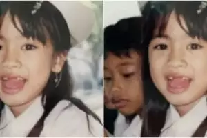 Bocah ompong ini dulunya pesinetron kondang, kini malah sukses jadi bos skincare