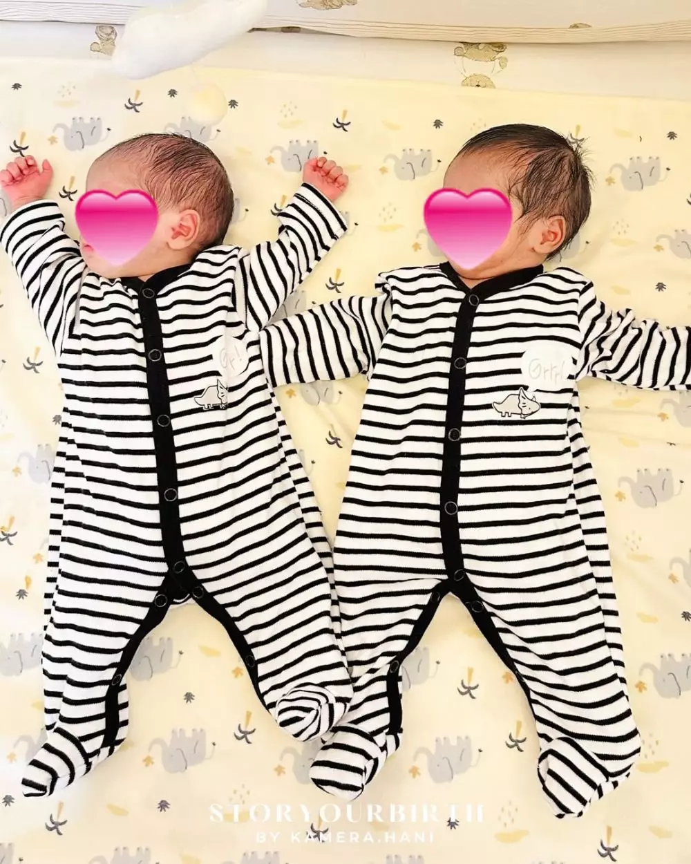 istri dennis lim melahirkan anak kembar © 2025 Instagram istri dennis lim melahirkan anak kembar © 2025 Instagram