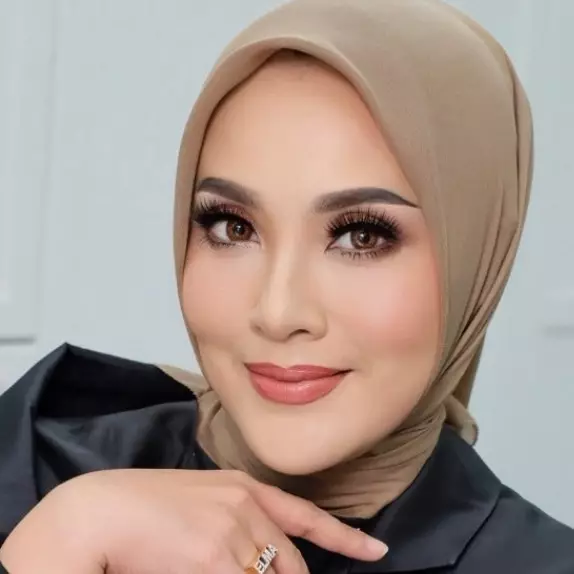 Lelah jalani perawatan wajah rutin, begini cerita Elma Theana putuskan oplas di usia 50 tahun