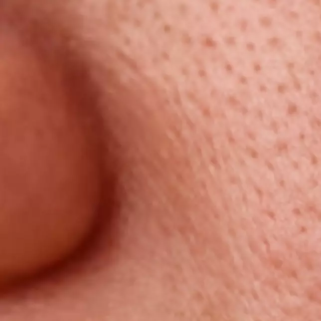 Cara simpel angkat komedo di pori-pori wajah pakai 2 jenis minuman, langsung bersih dala sekejap