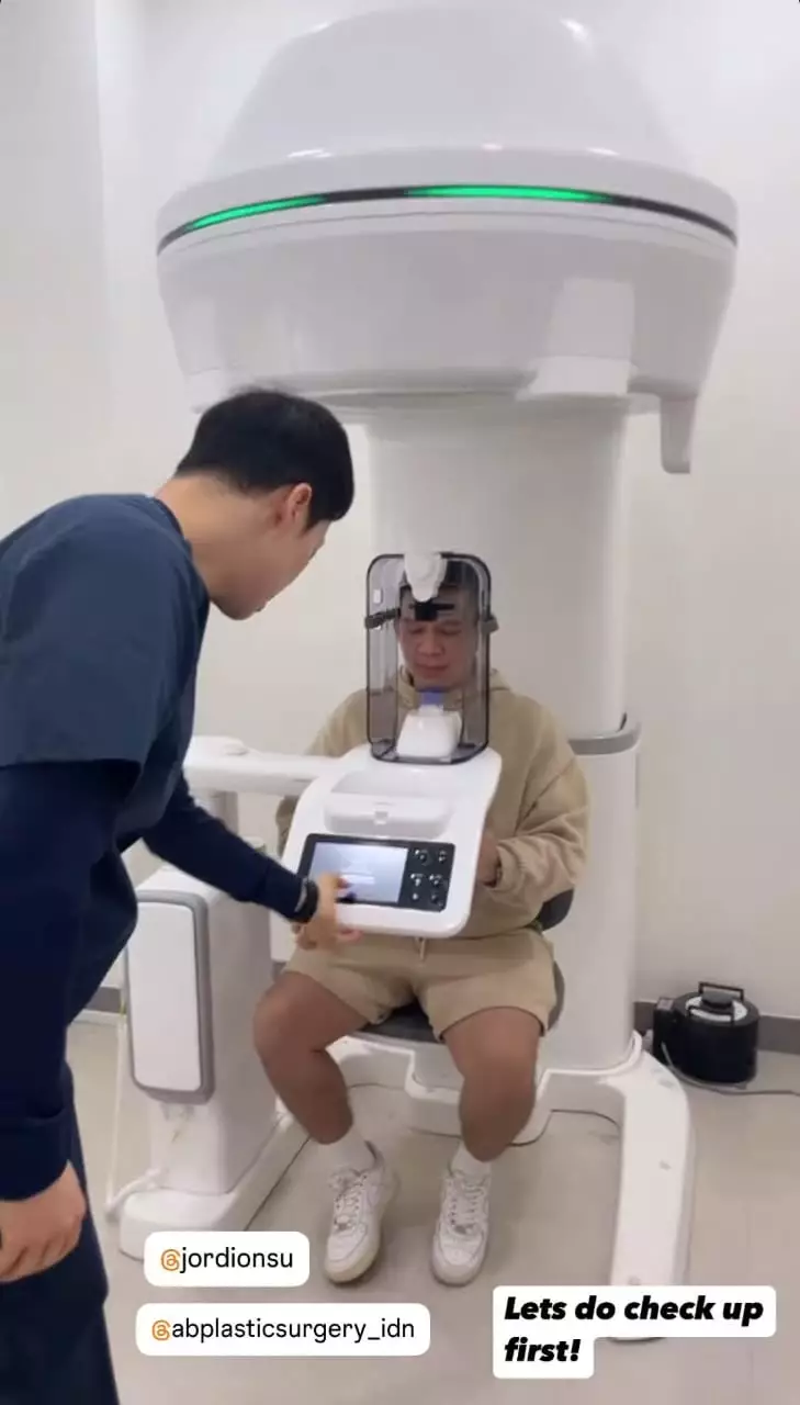 Jordi Onsu sebelum dan sesudah oplas © berbagai sumber