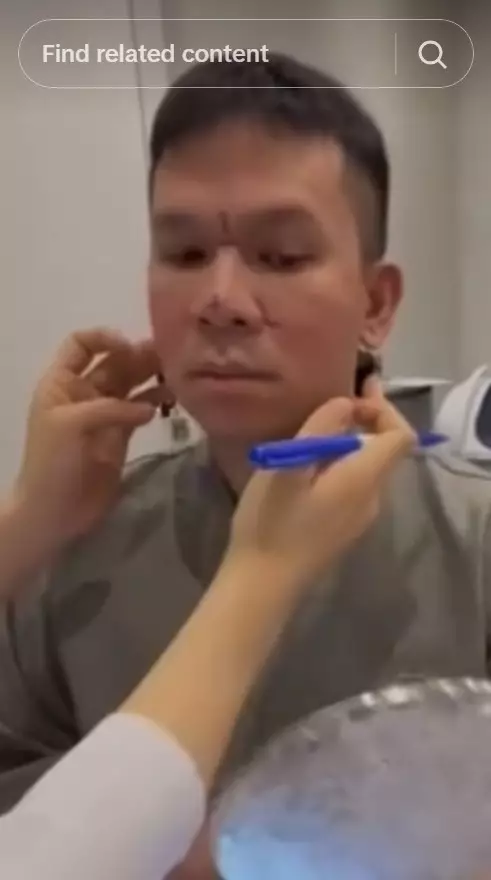 Jordi Onsu sebelum dan sesudah oplas © berbagai sumber