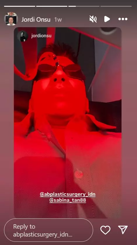 Jordi Onsu sebelum dan sesudah oplas © berbagai sumber