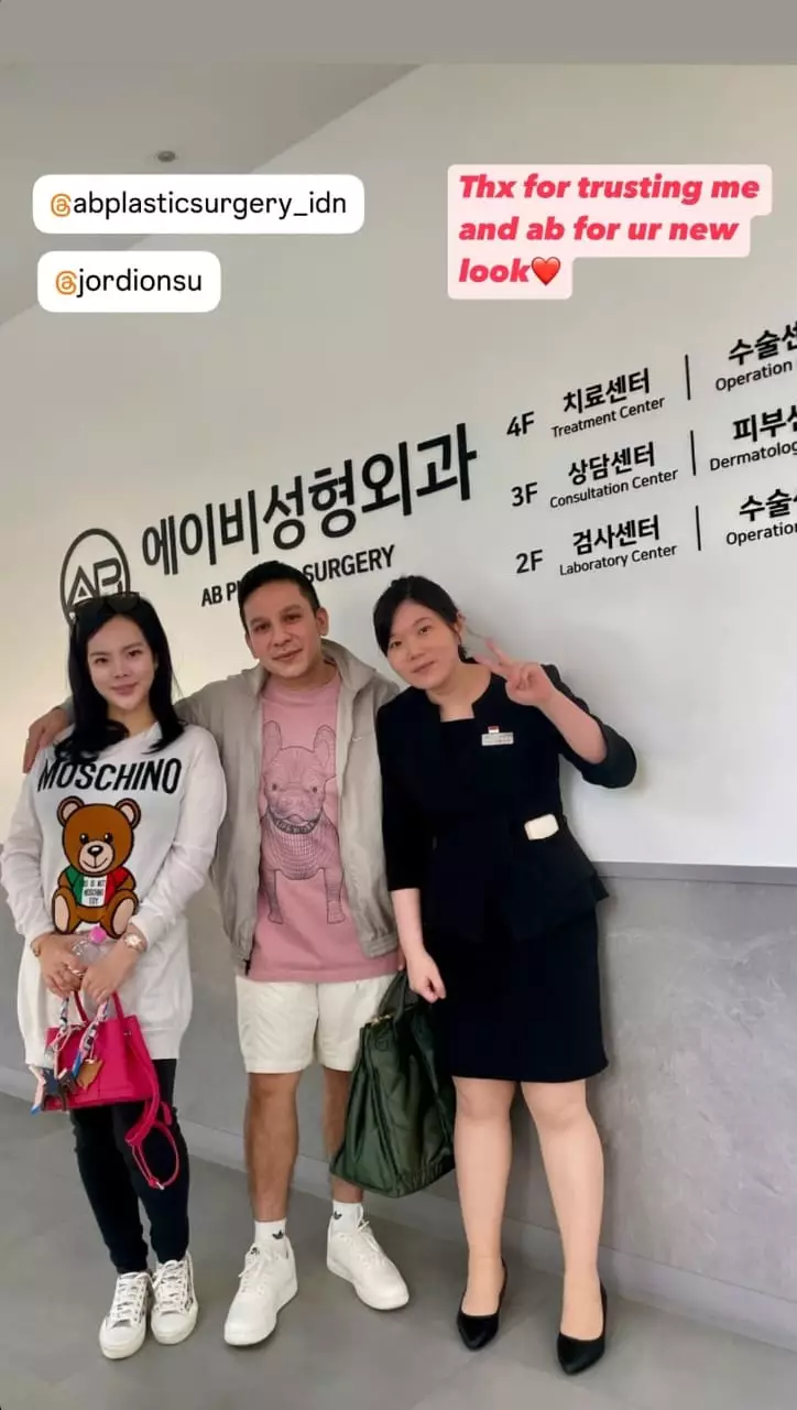 Jordi Onsu sebelum dan sesudah oplas © berbagai sumber