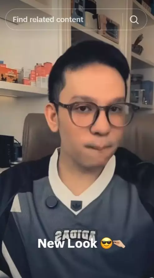 Jordi Onsu sebelum dan sesudah oplas © berbagai sumber