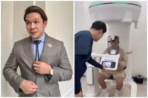 Permak wajah demi estetika, ini 7 potret Jordi Onsu sebelum dan sesudah oplas hidung di Korea Selatan