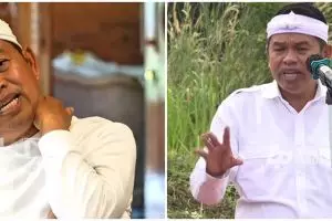 Tuai pro dan kontra, intip fakta-fakta menarik vasektomi jadi syarat dapat bansos di Jawa Barat