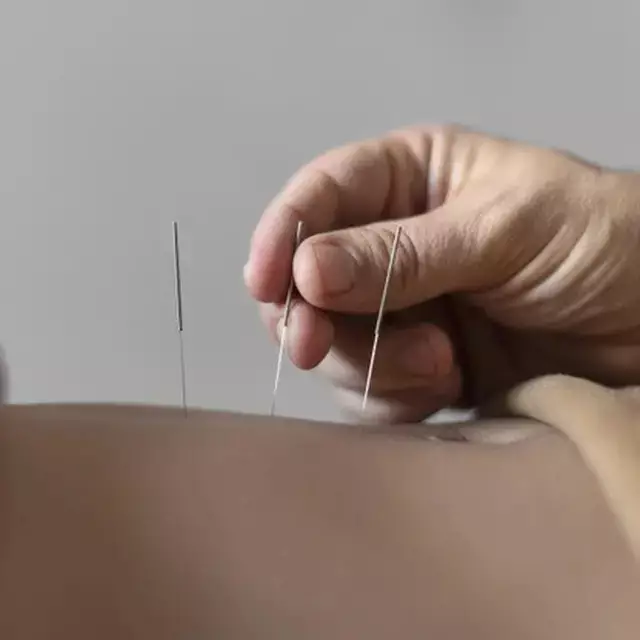 Kisah pria kena infeksi bakteri pemakan daging usai jalani akupunktur, endingnya bikin tragis